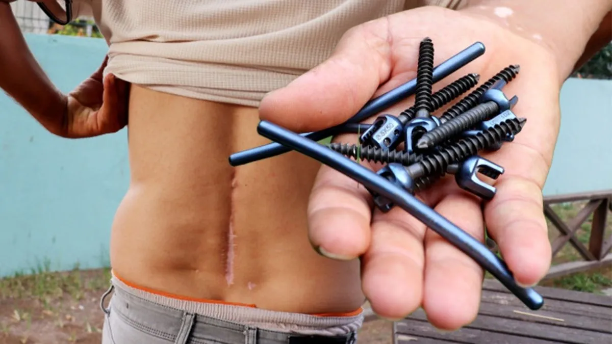 Bel  ameliyatları hayatını kararttı: Sakat kalacağımı söyledi! 9 platin ve Hepatit B